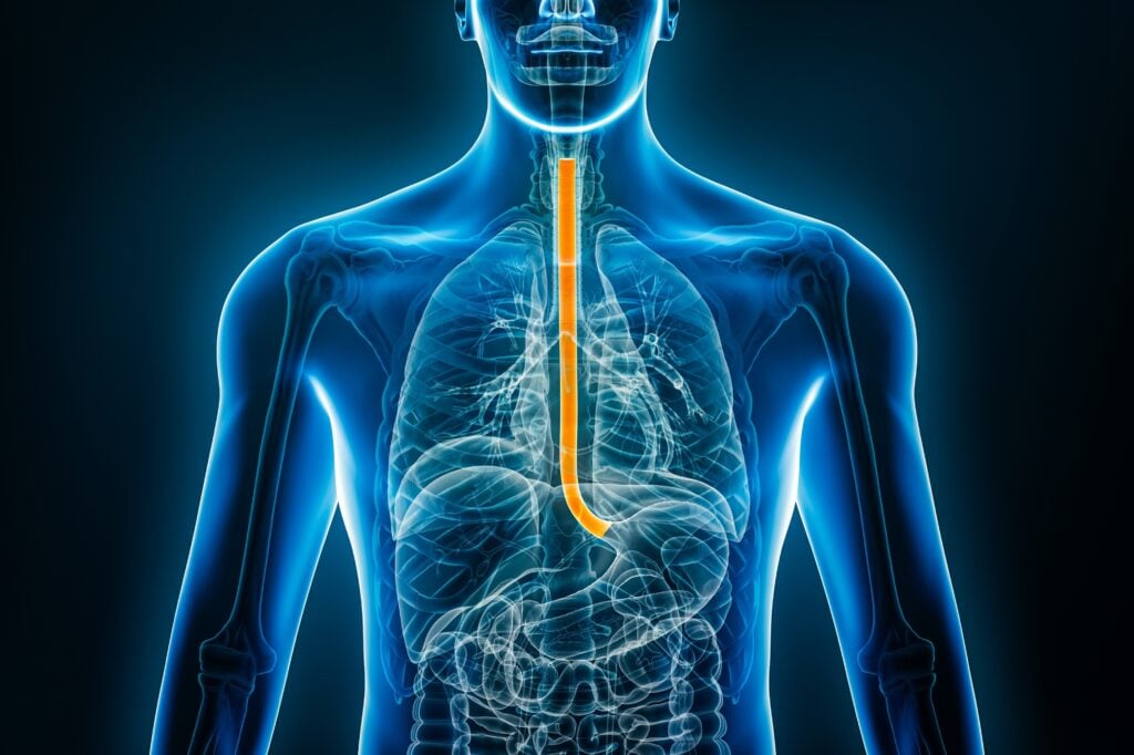 Eupraxia Pharmaceuticals: A Promising Player in the Biotech Space